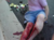 Broken leg_tiny